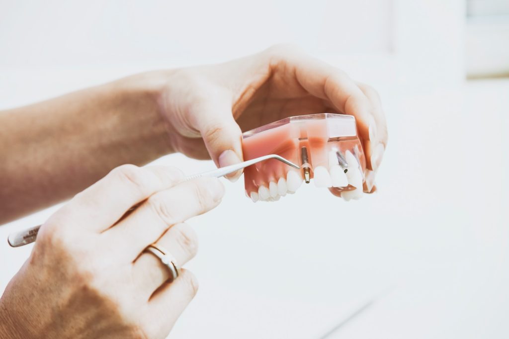 Person Wearing Silver-Colored Ring While Holding Denture